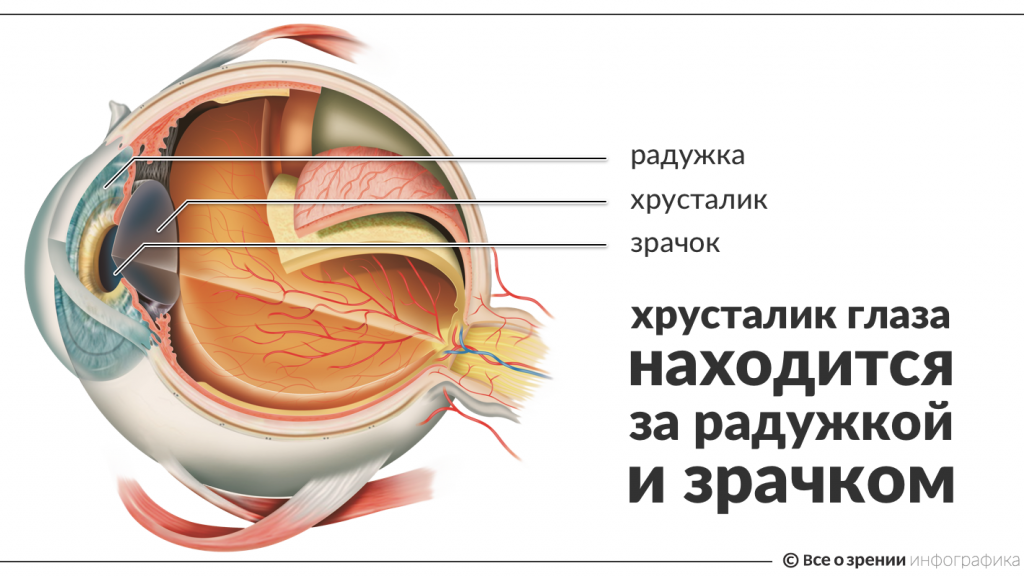 Симптомы, признаки катаракты